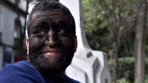 Image de Insolite. La diversité génétique au sein de l'espèce humaine peut souvent être à la base de la souffrance de plusieurs. c'est le cas de Chuy, un homme avec le visage et l'ensemble du corps recouvert de poils dont la densité est supérieure à la moyenne. A cause donc de ce problème génétique, il est classé et montré du doigt comme étant un loup-garou. Une situation qui influence négativement sa vie sociale. Une vie bien difficile pour cet homme de 41 connu à l'état civil sous le nom de Jesus Aceves.