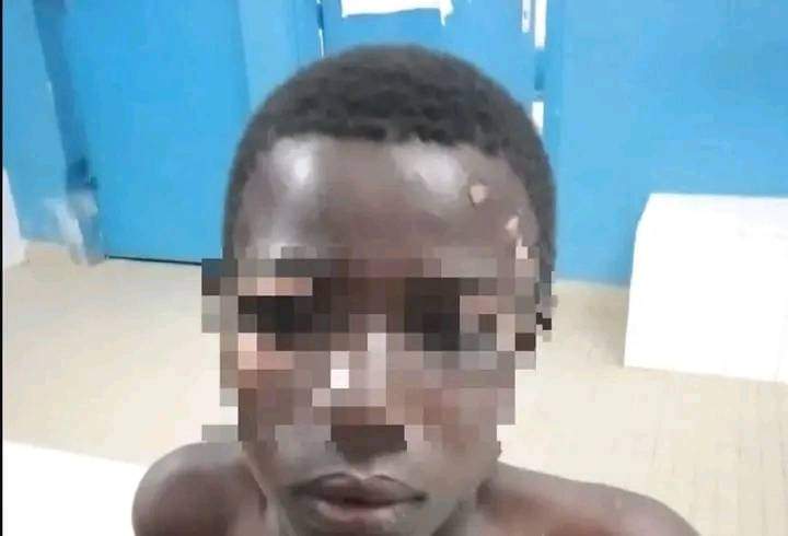 Image de Faits Divers. Les faits se seraient passés dans la commune de Cocody, à Abidjan. Un gamin de 13 ans a été gravement blessé au couteau par sa grand-mère qui l'accusait d'avoir dérobé un billet de 1000 F. Après son forfait que je mettrais sur le coup de la colère, la grand-mère a pris la poudre d'escampette. Que pensez-vous de la colère et ce qu'elle est capable de nous faire fait?